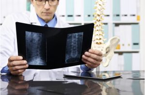 Headshot of Slipped Disc or Herniated Disc – What’s the Difference | BEST