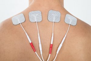 Headshot de por qué los pacientes obtienen estimuladores espinales | MEJOR