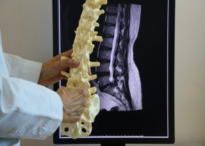 Headshot of Avoiding Failed Back Surgery Syndrome
